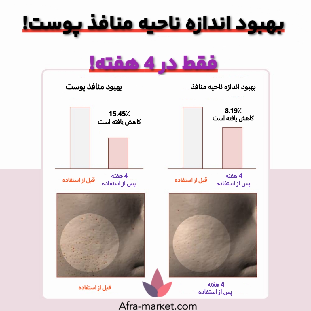 <img src="https://afra-market.com/skin1004-centella-toner" alt="تونر پاک‌کننده منافذ پوست Centella Madagascar، حاوی عصاره سنتلا، مناسب برای پوست‌های حساس و مستعد جوش، آرامش‌بخش و تسکین‌دهنده پوست، محصول اصل برند Skin1004، خرید از افرا مارکت">