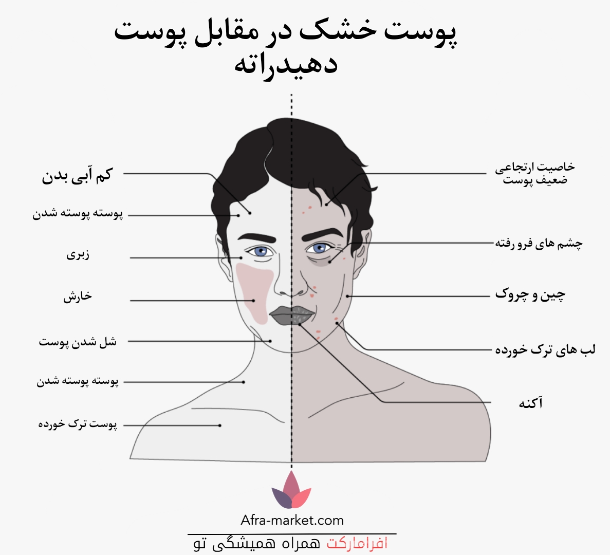 <h2>تفاوت پوست خشک و پوست دهیدراته</h2> <ul>   <li>#پوست_خشک</li>   <li>#پوست_دهیدراته</li>   <li>#نشانه_پوست</li>   <li>#مراقبت_پوست</li>   <li>#آبرسانی_پوست</li>   <li>#مرطوب_کننده</li>   <li>#سلامت_پوست</li> </ul>