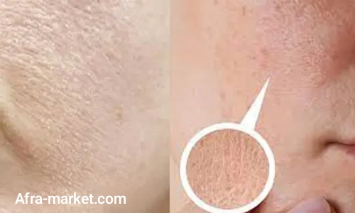 تونر کره ای برای پوست دهیدراته؟