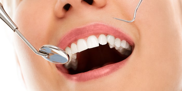 روش های سفید کردن دندان در خانه