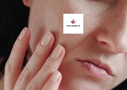 ۵ ضد آفتاب طبیعی برای پوست صورت