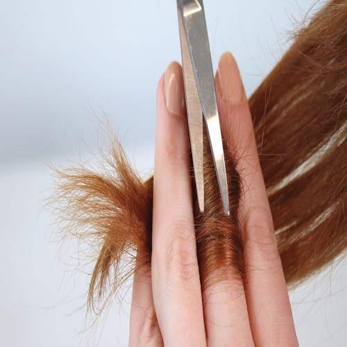 درمان خانگی و جلوگیری از موخوره سر