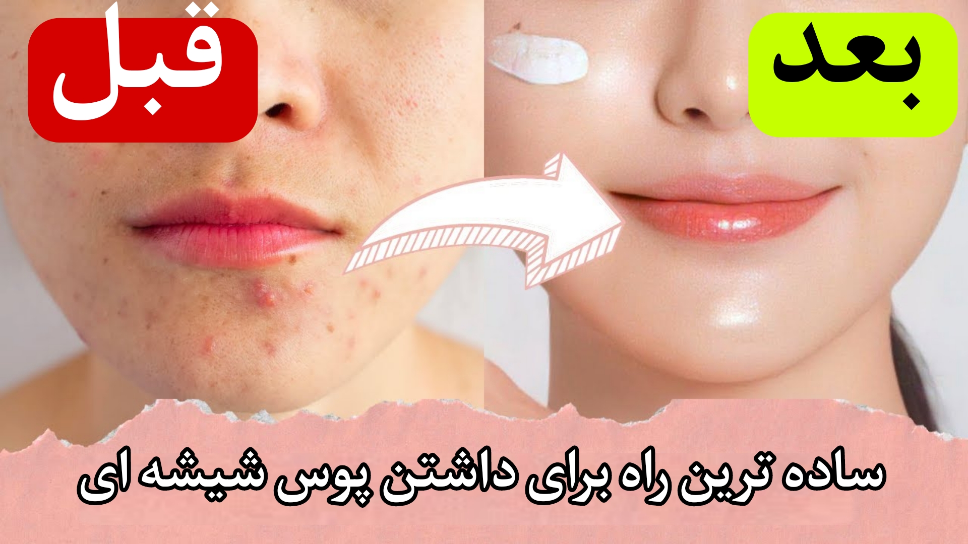 چگونه می‌توان پوست شیشه‌ای داشت؟ راهنمای کامل