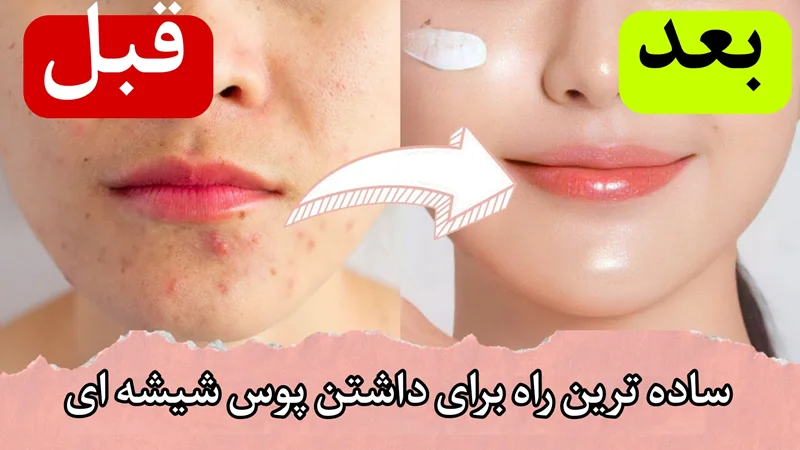 چگونه میتوان پوست شیشهای داشت؟ راهنمای کامل