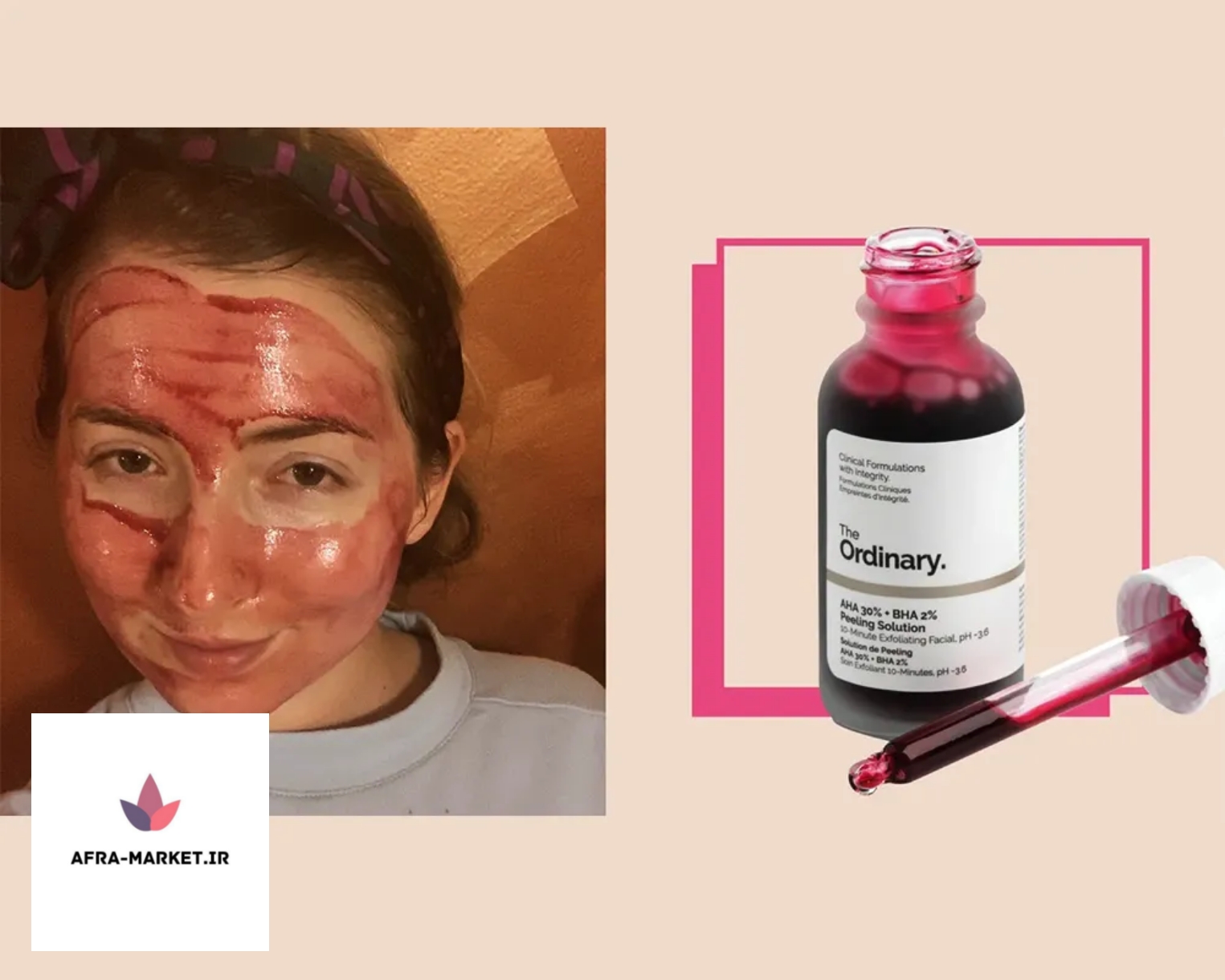 طرز استفاده از سرم لایه بردار اوردینری + نکات مهم