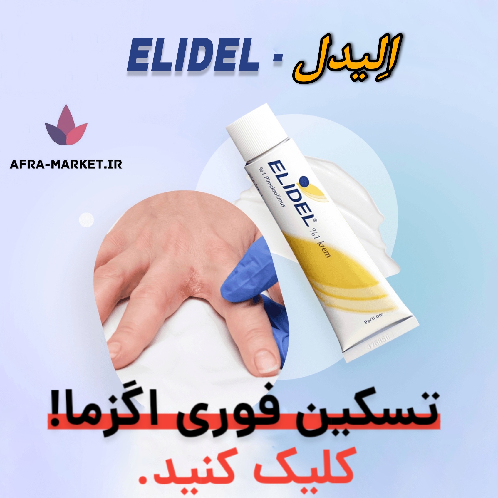 بهترین کرم ضد اگزما: معرفی کرم الیدل و فواید آن