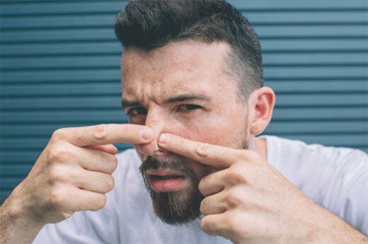 ساده‌ترین روش از بین بردن جای جوش روی صورت با این ماده غذایی