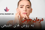 از بین بردن جوش به روش طب سنتی