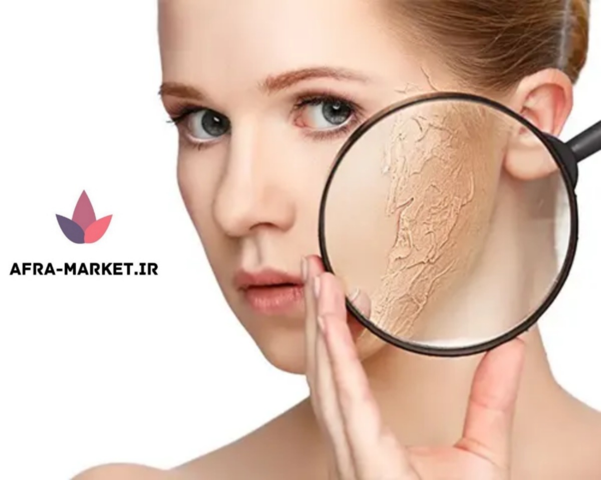 چرا باید پوست را لایه برداری کنیم؟