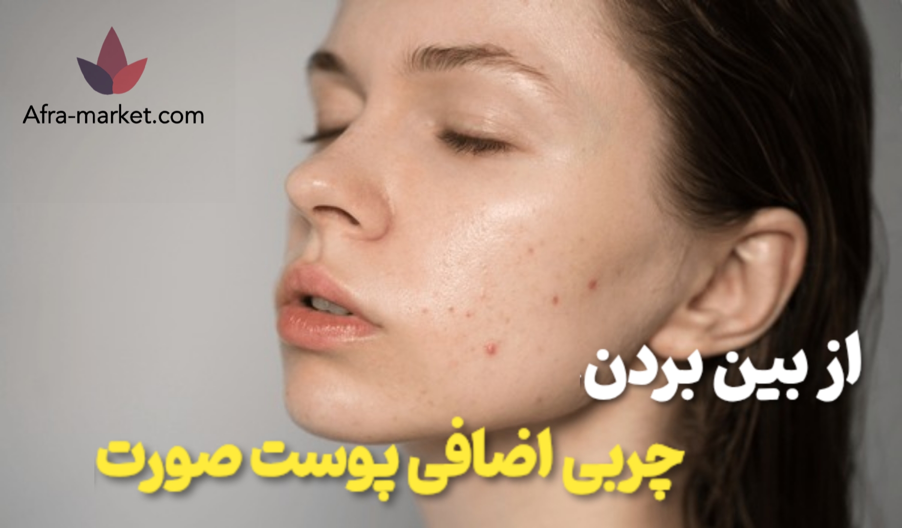 دلیل چربی‌ پوست صورت و کنترل چربی پوست