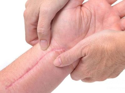 مزایای کرم ترمیم کننده پوست سیکالفیت اون